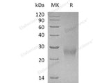 Recombinant Human CDK2AP2 Protein (Human Cells, His Tag)