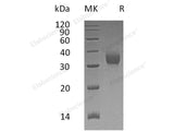 Recombinant Human CEACAM21 Protein (His Tag)