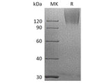 Recombinant Human CEACAM5/CEA Protein (His Tag) 