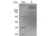 Recombinant Human CEACAM5/CEA Protein (Fc Tag) 