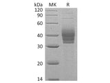 Recombinant Human Cerberus/CER1 Protein (His Tag)