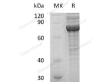 Recombinant Human PRKG1 Protein (His Tag)