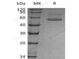 Recombinant Human Chitotriosidase/CHIT1 Protein (His Tag)
