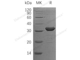 Recombinant Human CLIC2 Protein (His Tag)