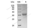 Recombinant Human Choriogonadotropin Subunit Beta 3/CGB3 Protein (His Tag)