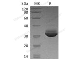 Recombinant Human CELA3A Protein (His Tag) 