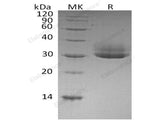 Recombinant Human CTRL Protein (His Tag)