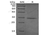 Recombinant Human Chymotrypsinogen B/CTRB1 Protein (His Tag)