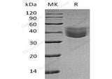 Recombinant Human CLEC10A/CD301 Protein (His Tag)