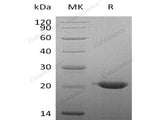 Recombinant Human CLEC3B/Tetranectin Protein (His Tag)