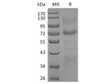 Recombinant Human Clusterin/ApoJ Protein (Fc & His Tag)