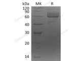 Recombinant Human CLUL1 Protein (His Tag)