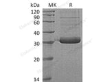 Recombinant Human Collectin-11/COLEC11 Protein (His Tag)