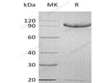 Recombinant Human CD93/C1QR1 Protein (aa 24-580, His Tag)