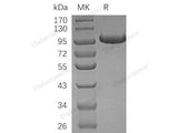 Recombinant Human Complement Factor B/CFB Protein (His Tag)