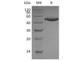 Recombinant Human Complement Factor H/CFH Protein (His Tag)