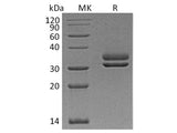 Recombinant Human CFHR2 Protein (His Tag)