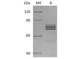 Recombinant Human CTGF/CCN2 Protein (Fc Tag)