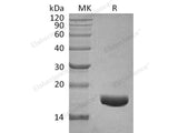 Recombinant Human CTGF/CCN2 Protein