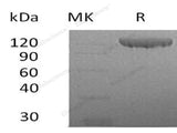 Recombinant Human Contactin 2/CNTN2 Protein (His Tag)