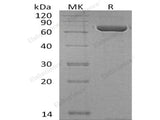 Recombinant Human Copine-1/CPNE1 Protein (His Tag)