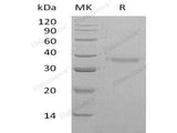 Recombinant Human CRHBP Protein (His Tag) 