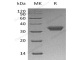 Recombinant Human CXADR/CAR Protein (His Tag)