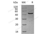 Recombinant Human Creatine Kinase, Muscle/CKM Protein (His Tag)