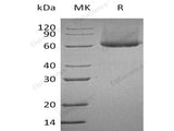 Recombinant Human CRTAM /CD355 Protein (His Tag)(Active)