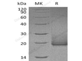 Recombinant Human Cryptic/CFC1 Protein (His Tag)