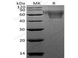 Recombinant Human CX3CL1/Fractalkine Protein (His Tag)