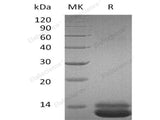 Recombinant Human CXCL1 Protein (His Tag) 