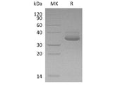 Recombinant Human CXCL10 Protein (Fc & His Tag)