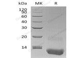 Recombinant Human CXCL3/GRO gamma Protein (His Tag)