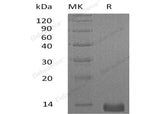 Recombinant Human CXCL4/PF4 Protein (His Tag)