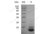 Recombinant Human CXCL5 Protein