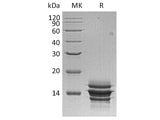 Recombinant Human CXCL7/NAP-2 Protein (His Tag)