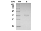 Recombinant Human CDKN1B Protein (His Tag)