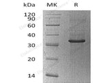 Recombinant Human Cyclophilin C/PPIC Protein (His&Trx Tag)