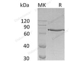 Recombinant Human Cyr61/CCN1 Protein (Fc Tag)