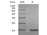 Recombinant Human Cystatin A/CSTA Protein (His Tag) 