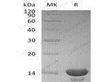 Recombinant Human Cystatin C/CST3 Protein (E.coli)