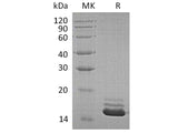 Recombinant Human Cystatin C/CST3 Protein (Human Cells, His Tag)