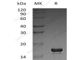 Recombinant Human Cystatin C/CST3 Protein (E.coli, His Tag)