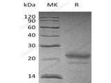 Recombinant Human Cystatin 7/CST7 Protein (His Tag)