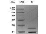 Recombinant Human Cystatin E/CST6 Protein (His Tag)