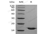 Recombinant Human Cystatin SA/CST2 Protein (His Tag)