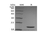 Recombinant Human Cystatin SN/CST1 Protein (His Tag)