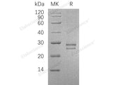 Recombinant Human CRISP3/SGP28 Protein (His Tag)