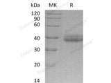 Recombinant Human CRELD2 Protein (His Tag)